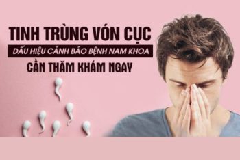 Cách chữa tinh trùng vón cục hiệu quả hiện nay