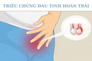 Bị đau tinh hoàn trái: cẩn thận với triệu chứng nguy hiểm này