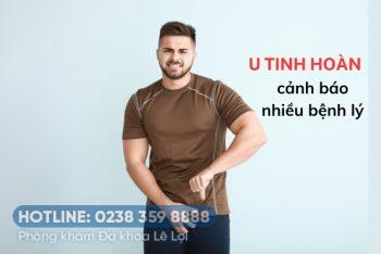 U tinh hoàn – Căn bệnh mà nam giới cần phải đề phòng