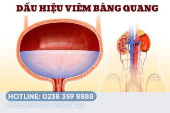 Bệnh viêm bàng quang và những kiến thức cần biết