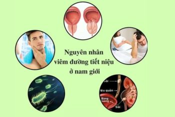 Viêm đường tiết niệu nguyên nhân dấu hiệu và cách chữa