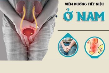 Viêm đường tiết niệu ở nam giới và những kiến thức cần biết?