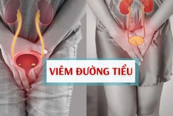 Viêm đường tiểu ở nam và nữ có nguy hiểm không và xử lý thế nào