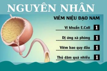 Các giải pháp hỗ trợ chữa viêm niệu đạo hiệu quả