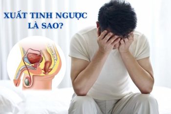 Chứng xuất tinh ngược và những biến chứng nguy hiểm