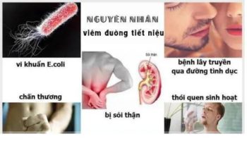 Nguyên nhân viêm đường tiết niệu