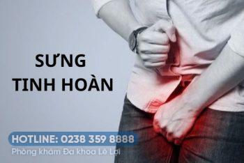 Sưng tinh hoàn là bị bệnh gì nguy hiểm không?