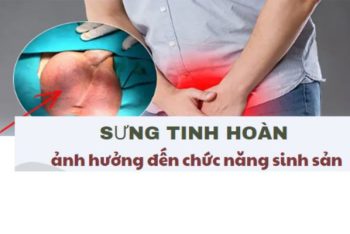 Sưng tinh hoàn là bị bệnh gì nguy hiểm không?