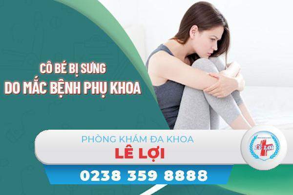 Cô bé bị sưng phải làm sao?