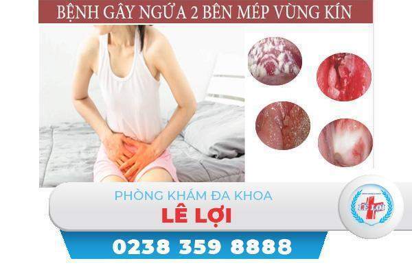 Ngứa mép âm đạo vùng kín nguyên nhân và cách chữa