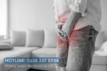 Ngứa vùng kín ở nam giới là bệnh gì?