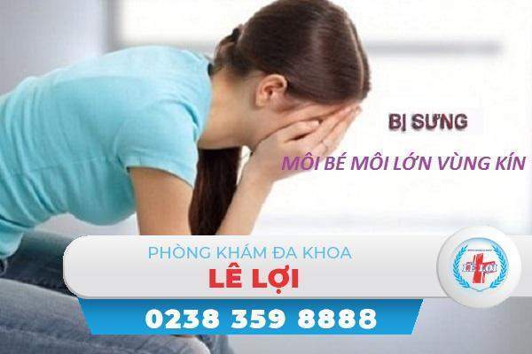 Sưng môi bé môi lớn vùng kín là bệnh gì?