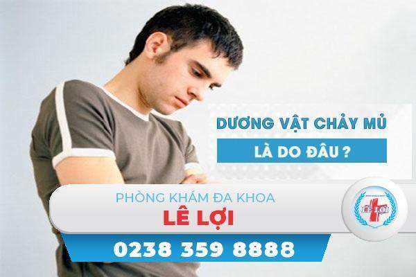 Dương vật chảy mủ là bị bệnh gì?