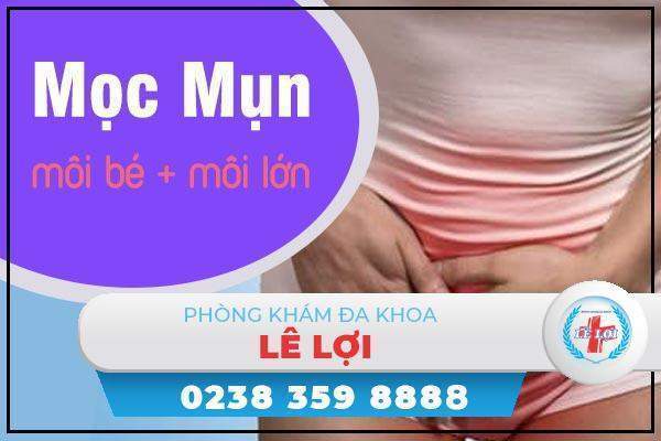 Hết sức lưu ý tình trạng mọc mụn môi bé, môi lớn