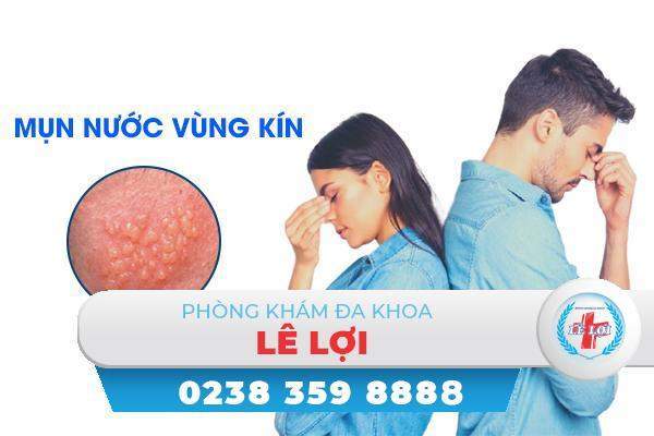 Mụn nước ở vùng kín là gì?