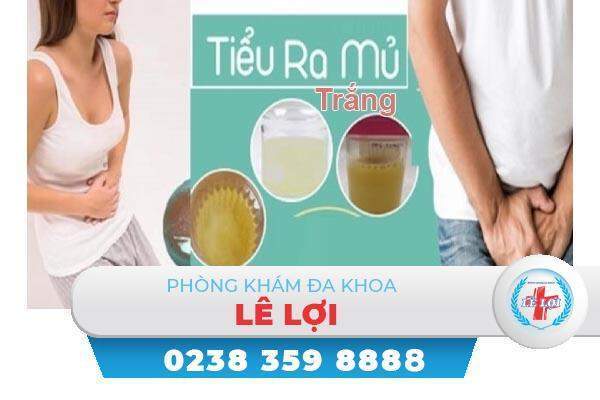 Tiểu ra mủ trắng nguy hiểm không?