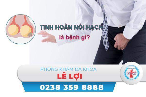 Tinh hoàn nổi hạch là bệnh gì nguy hiểm không?