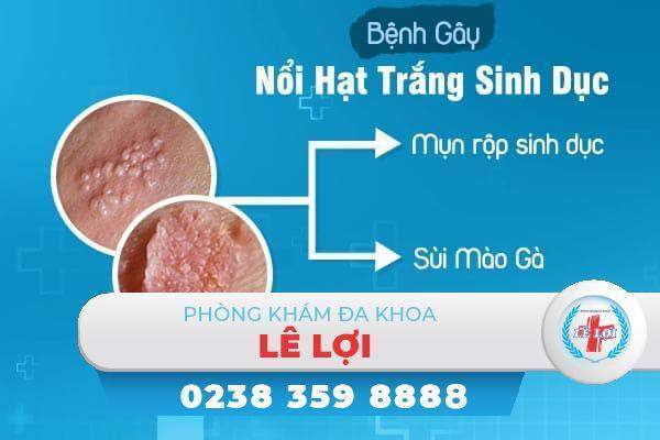 tinh-trang-noi-hat-trang-sinh-duc-la-benh-gi-1