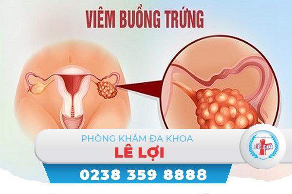 Viêm buồng trứng và những điều cần biết