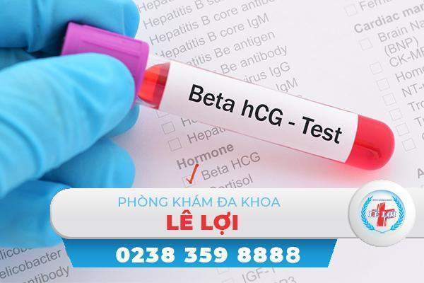 Xét nghiệm beta HCG là gì? Các vấn đề cần lưu ý khi thực hiện xét nghiệm