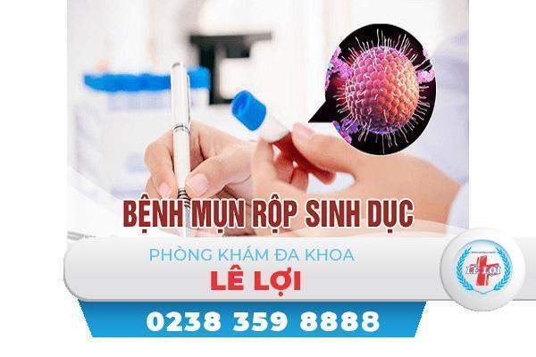 Xét nghiệm mụn rộp sinh dục cần thực hiện những gì?