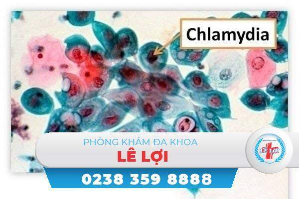 Bệnh chlamydia và những điều cần biết