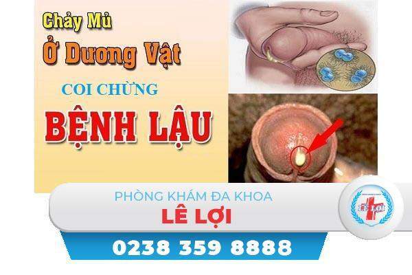 Thận trọng khi đầu dương vật chảy mủ