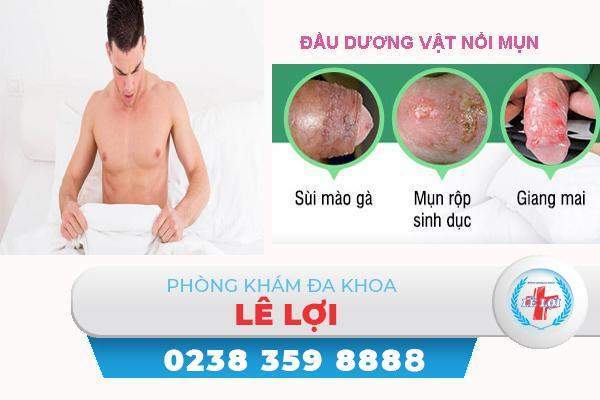 Điều trị đầu dương vật nổi mụn là bệnh gì?