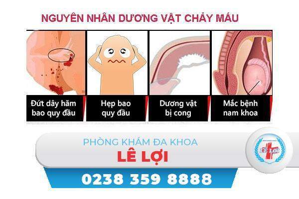 Dương vật chảy máu là bị bệnh gì?