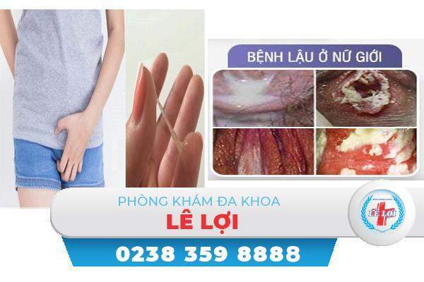 Hột le chảy mủ là bệnh gì?