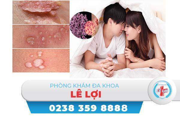 Mụn cơm hoa liễu là bệnh gì?