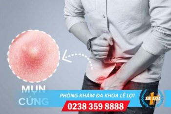 Nổi mụn cứng dương vật nguy hiểm không?