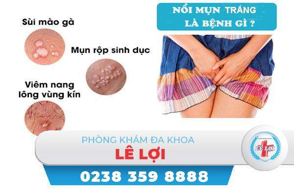 Những điều cần biết về hiện tượng nổi mụn trắng ở nữ