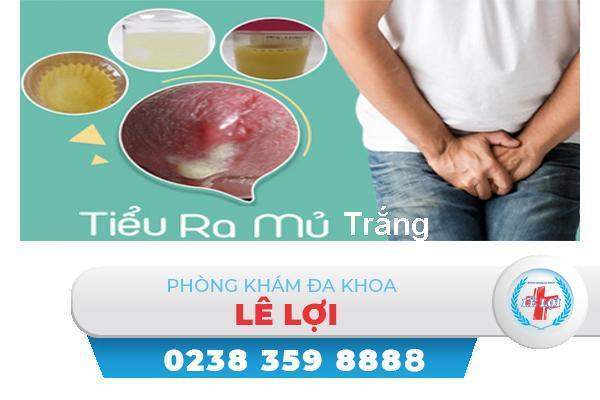 Tiểu ra mủ trắng cảnh báo bệnh gì?