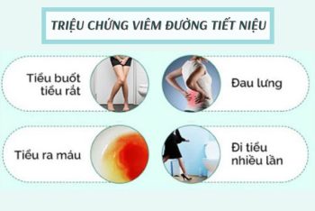 Triệu chứng viêm đường tiết niệu và cách điều trị