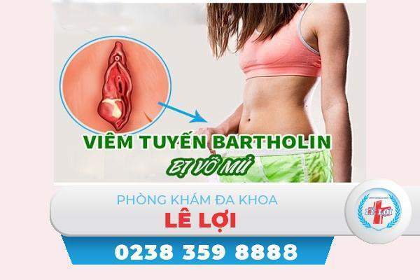 Viêm tuyến bartholin có nguy hiểm không?