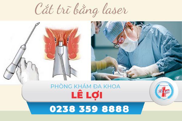 Cắt trĩ bằng laser và những điều cần biết