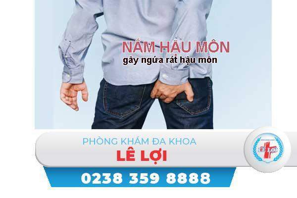 Nguyên nhân dấu hiệu và cách điều trị nấm hậu môn