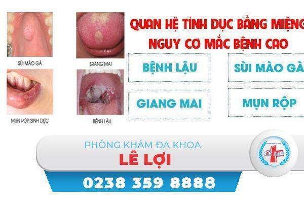 Quan hệ đường miệng lây bệnh gì?