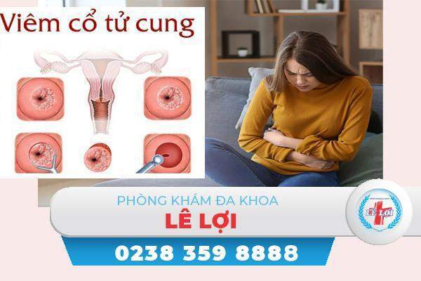 Dấu hiệu viêm cổ tử cung nặng và nhẹ