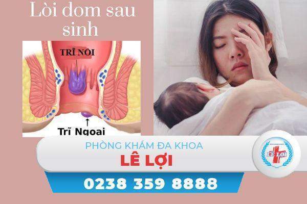 Lòi dom sau sinh dấu hiệu và cách điều trị