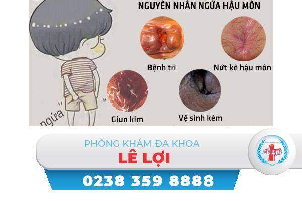 Nguyên nhân gây ngứa đít và cách khắc phục