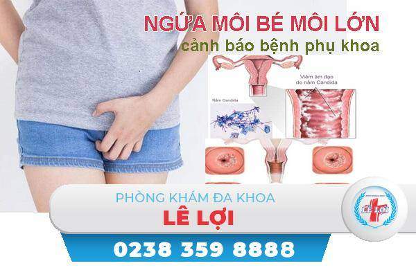 Ngứa môi bé môi lớn phải làm sao?