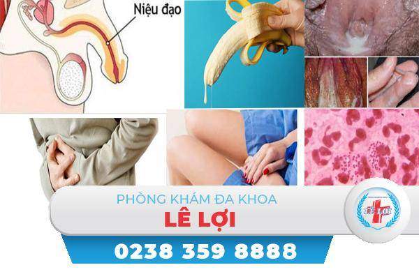 Tiết dịch niệu đạo bất thường nguyên nhân và cách điều trị