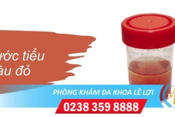 Nước tiểu màu đỏ là bị bệnh gì?