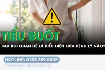 Tiểu buốt sau khi quan hệ phải làm sao?