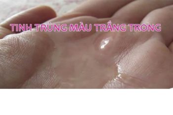 Tinh trùng màu trắng trong có bị bệnh gì không?