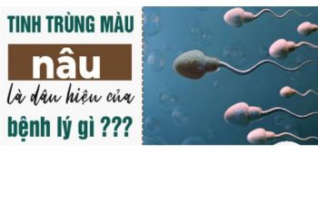 Tinh trùng màu nâu cảnh báo bệnh gì?