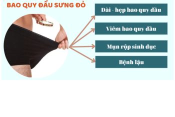 Bao quy đầu sưng đỏ là bệnh gì và cách chữa trị