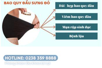 Bao quy đầu sưng đỏ là bệnh gì và cách chữa trị
